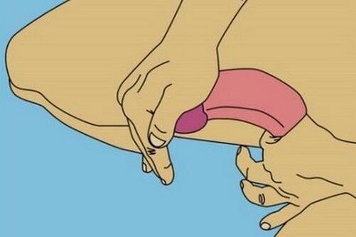 弯曲阴茎以增大头部