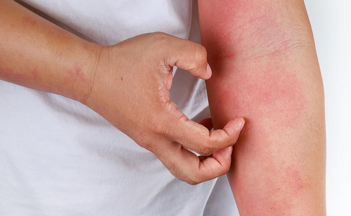 使用苏打水可能出现的并发症